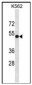 PVR/CD155 Polyclonal Antibody